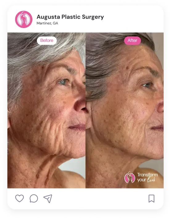 Social media post for AugustaPlasticSurgery